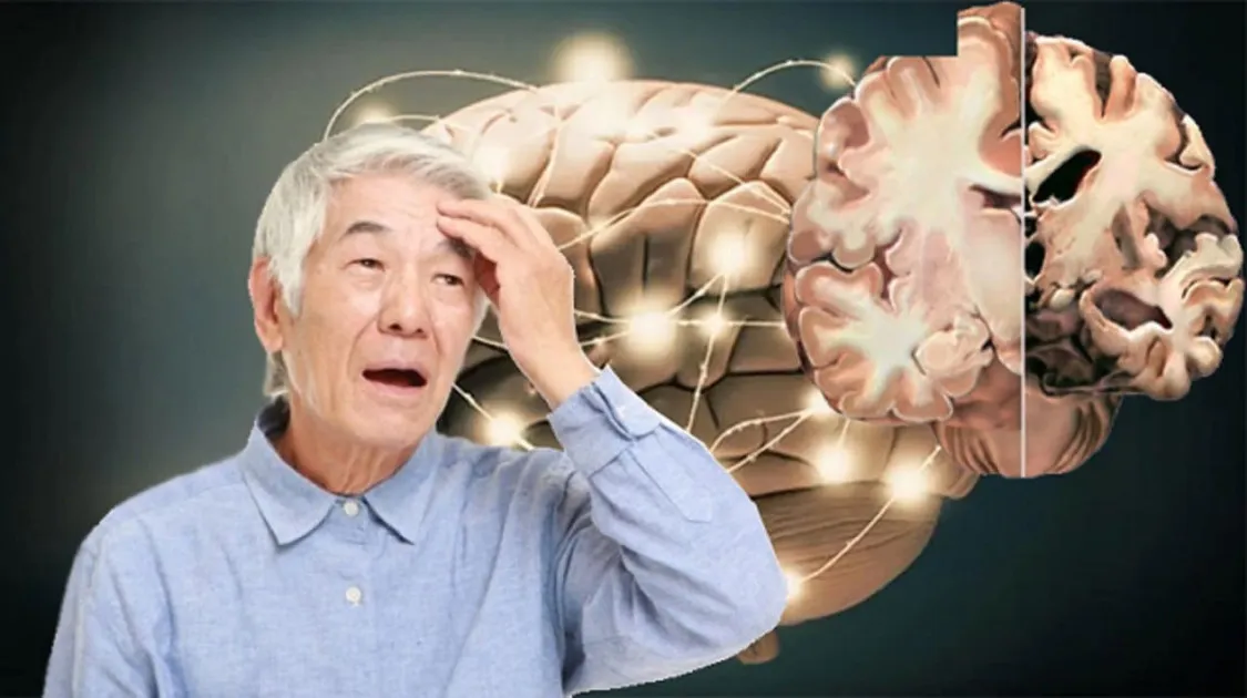 Giấc ngủ có liên quan đến bệnh Alzheimer không? Các triệu chứng của giấc ngủ báo hiệu cho căn bệnh Alzheimer