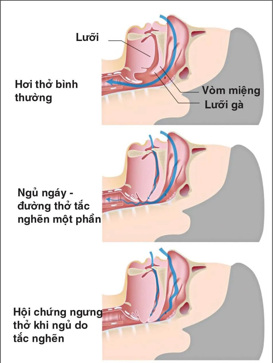 Lợi ích tuyệt vời của gối kê cổ cao su thiên nhiên